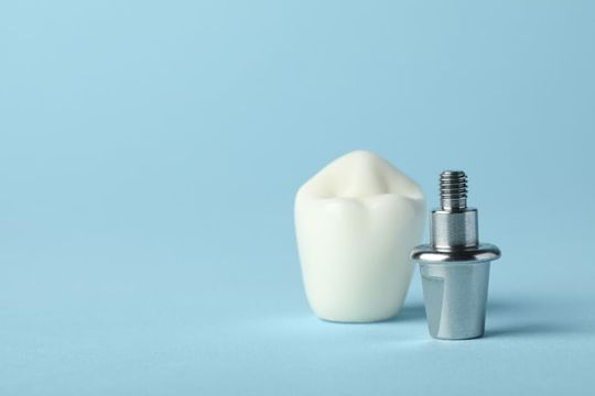 pieza dental e implante